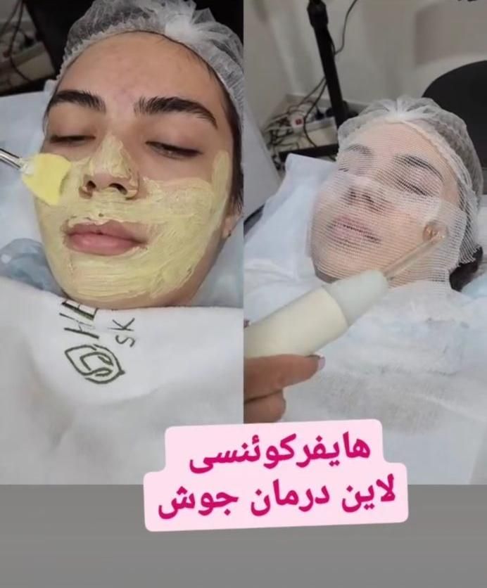 پاکسازی و فیشال صورت و آموزش تخصصی|خدمات آرایشگری و زیبایی|تهران, پیروزی|دیوار