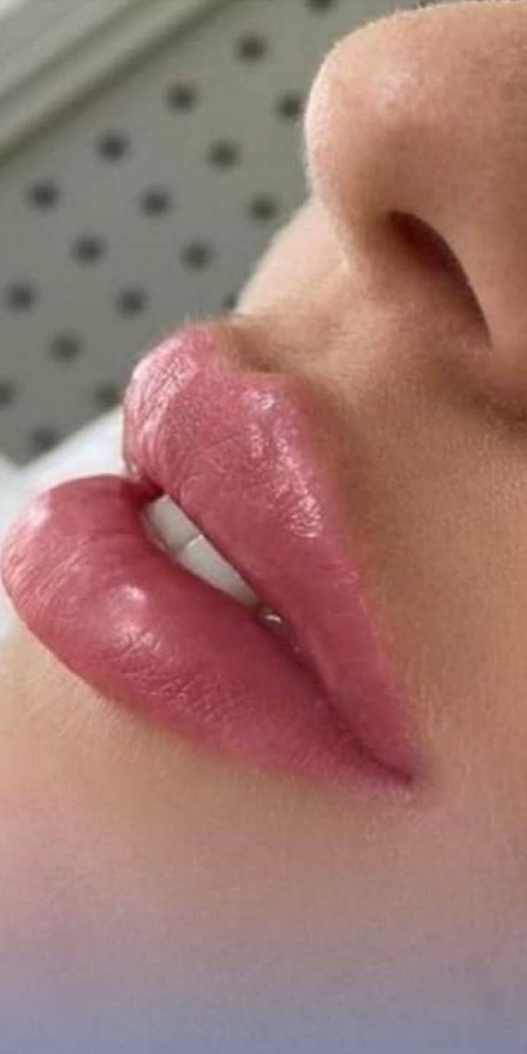 جشنواره مرکز تزریق چربی صورت ،ژل ،بوتاکس.prp|خدمات آرایشگری و زیبایی|کرج, اصفهانی‌ها|دیوار