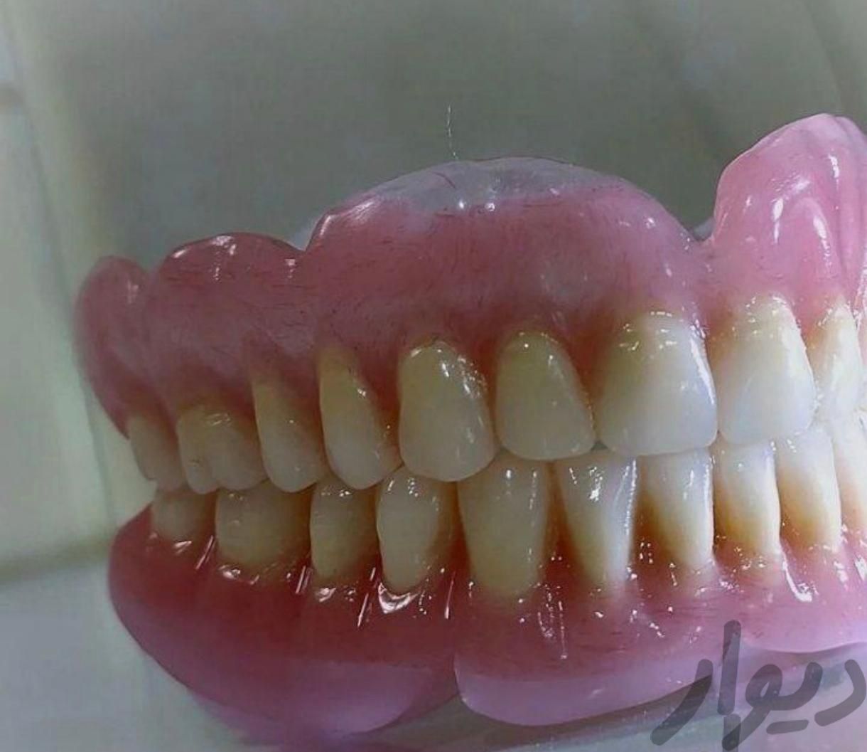 دندانسازی ساخت دندان مصنوعی|خدمات آرایشگری و زیبایی|اصفهان, کلمان|دیوار