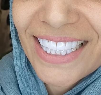 دندانپزشکی.ارتودنسی.عصب کشی.کامپوزیت|خدمات آرایشگری و زیبایی|تهران, مجیدیه|دیوار