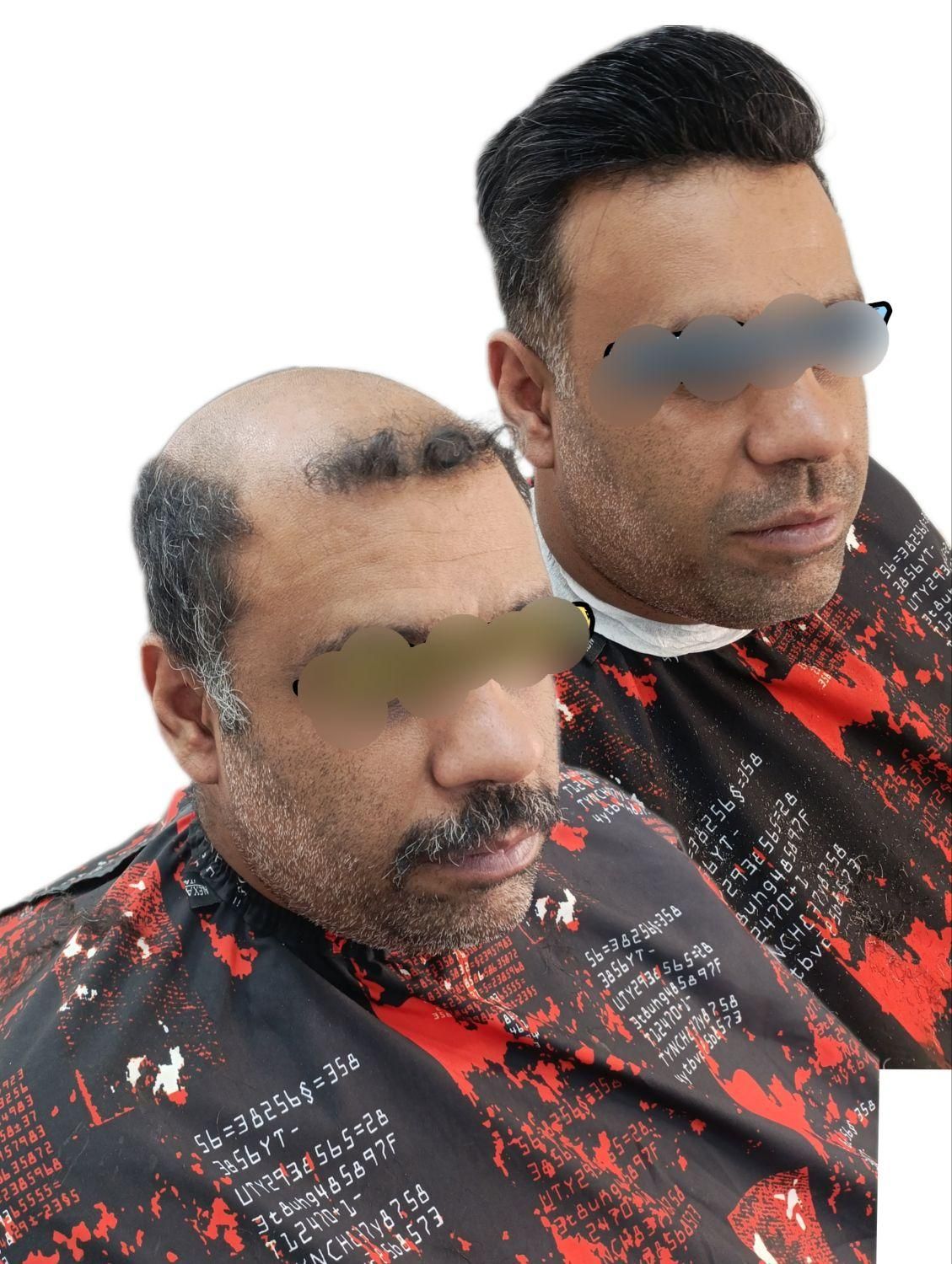جشنواره نوروزی فروش پروتزمو وارداتی 40%تخفیف|خدمات آرایشگری و زیبایی|شیراز, صاحب الزمان|دیوار