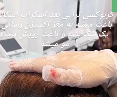 درمان ریزش مو و رشد مجدد مو فقط در چند جلسه|خدمات آرایشگری و زیبایی|مشهد, قوچان|دیوار