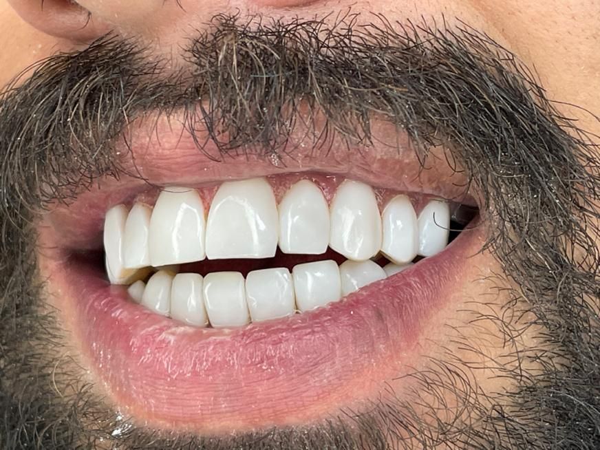 خدمات اقساطی دندانپزشکی|خدمات آرایشگری و زیبایی|تهران, سعادت‌آباد|دیوار