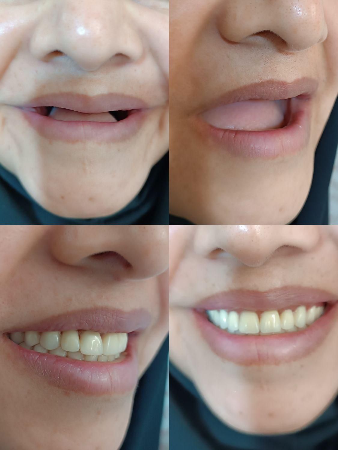 انجام کلیه خدمات دندان مصنوعی|خدمات آرایشگری و زیبایی|تربت‌حیدریه, |دیوار
