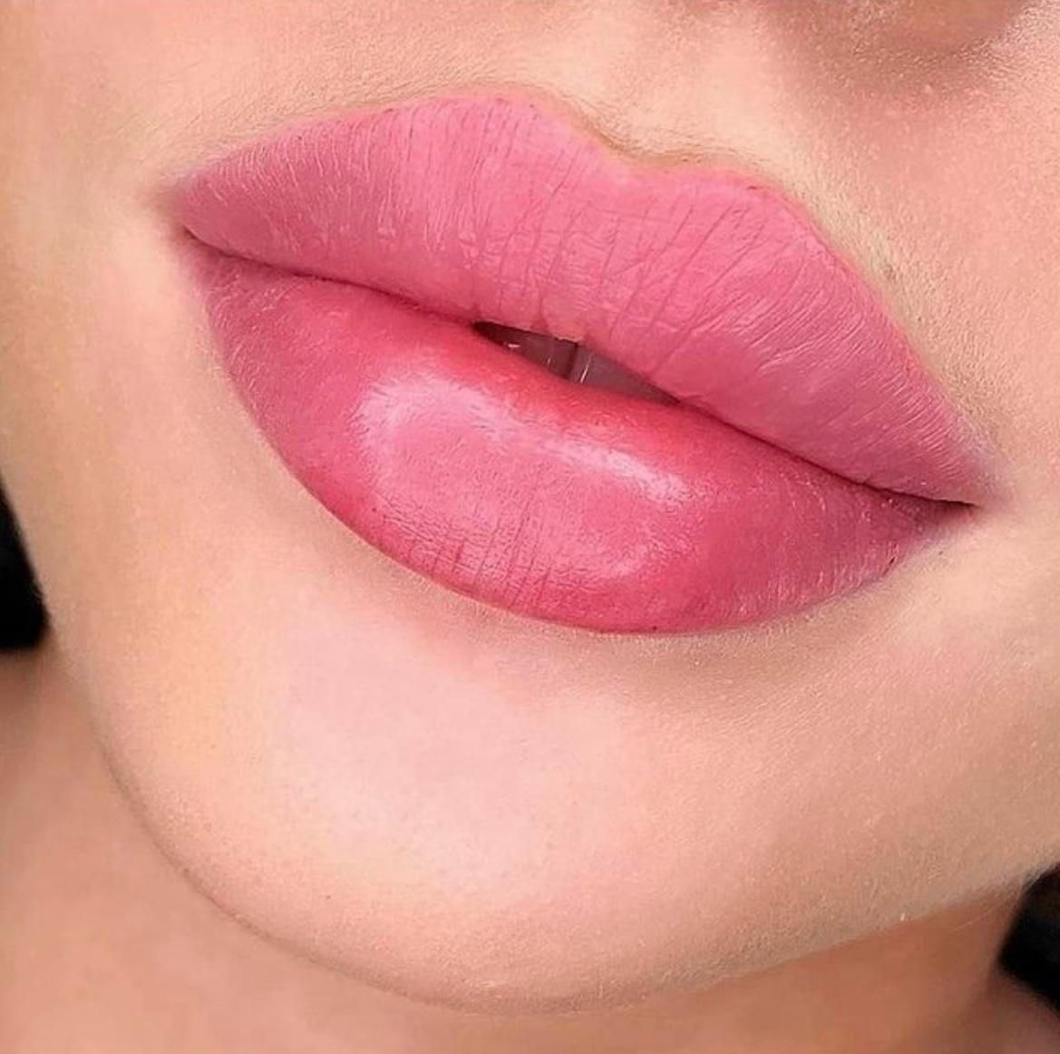 ژل لب مدل روسی و طبیعی بوتاکس میگرن مزوژل|خدمات آرایشگری و زیبایی|تهران, شاهین|دیوار