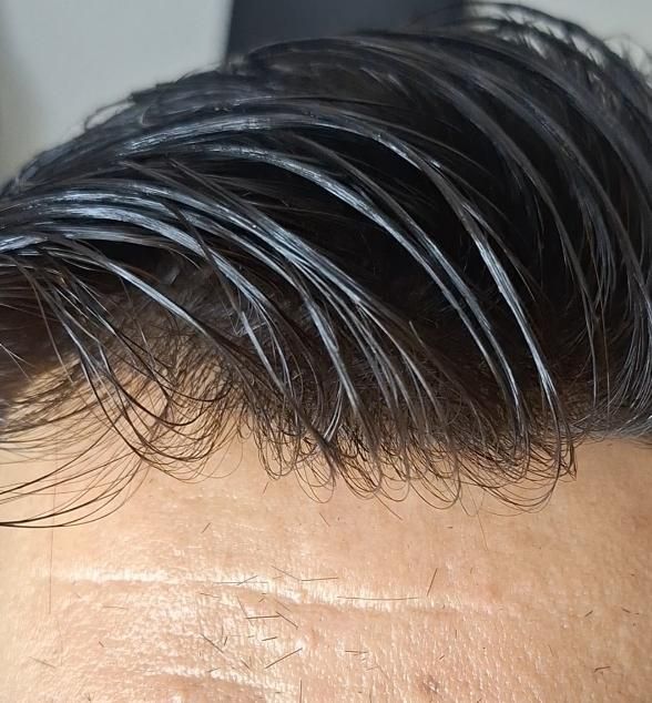 فروش اقساطی پروتز مو وارداتی درجه ۱|آرایشی، بهداشتی، درمانی|تهران, کوی فردوس|دیوار