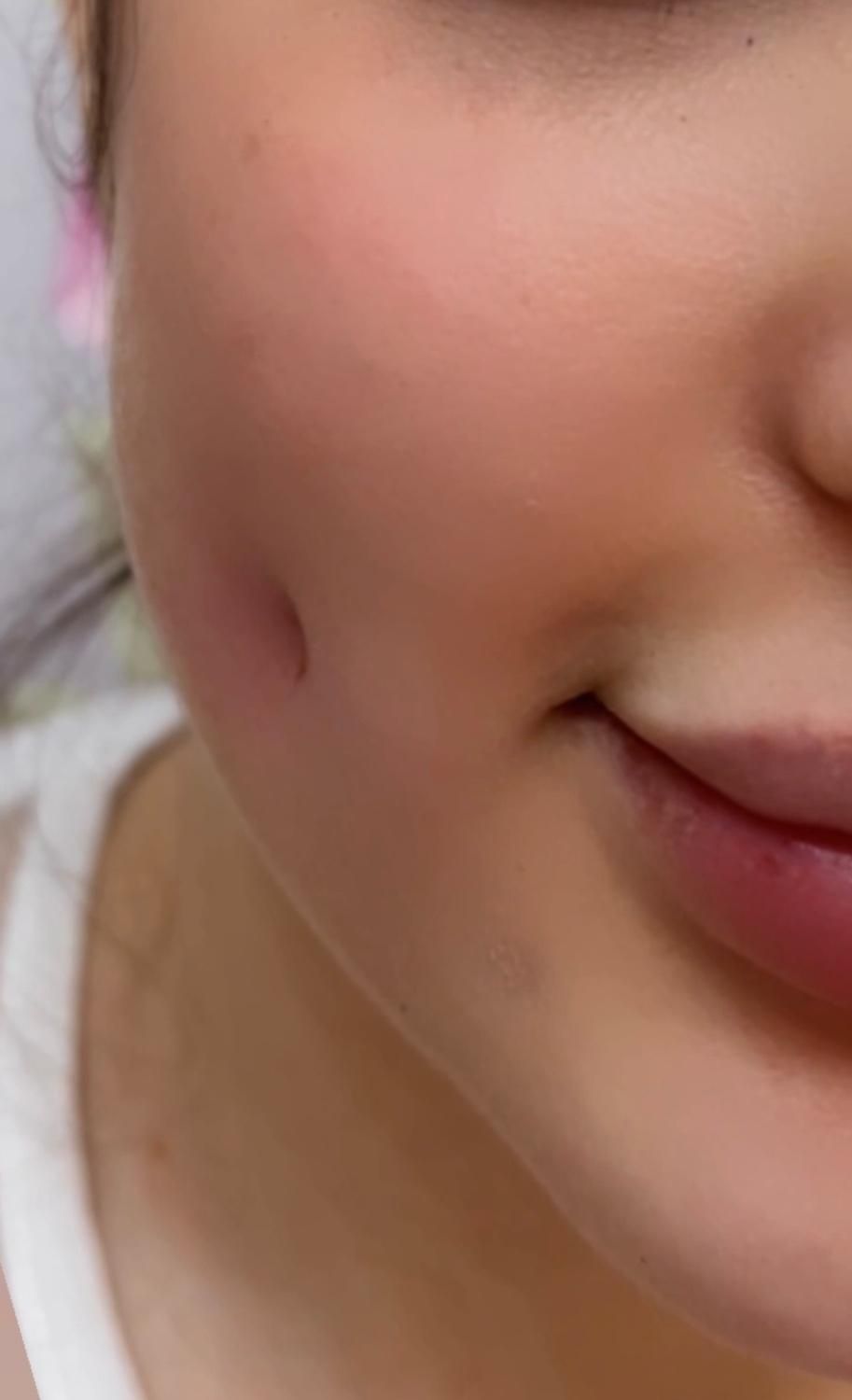 آموزش فوق تخصصی پرسینگ میکرو چال لپ|خدمات آموزشی|تهران, بهاران|دیوار
