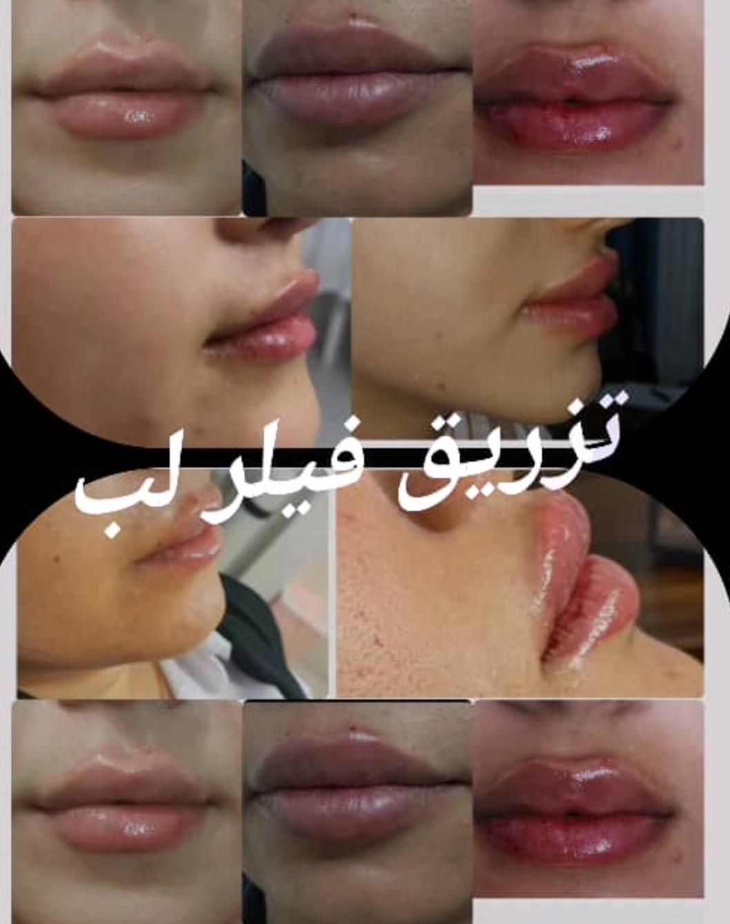مطب زیبایی ولیزر دکتر محمود مجملی|خدمات آرایشگری و زیبایی|اصفهان, باغ زرشک|دیوار