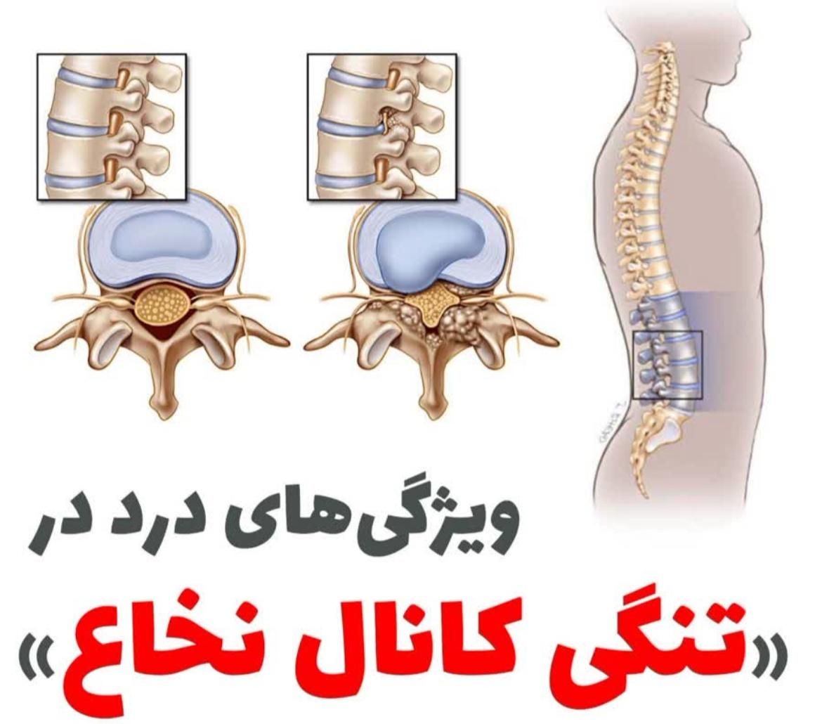 کایروپراکتیک درمان بیماری ها|خدمات آرایشگری و زیبایی|تهران, امام سجاد(ع)|دیوار