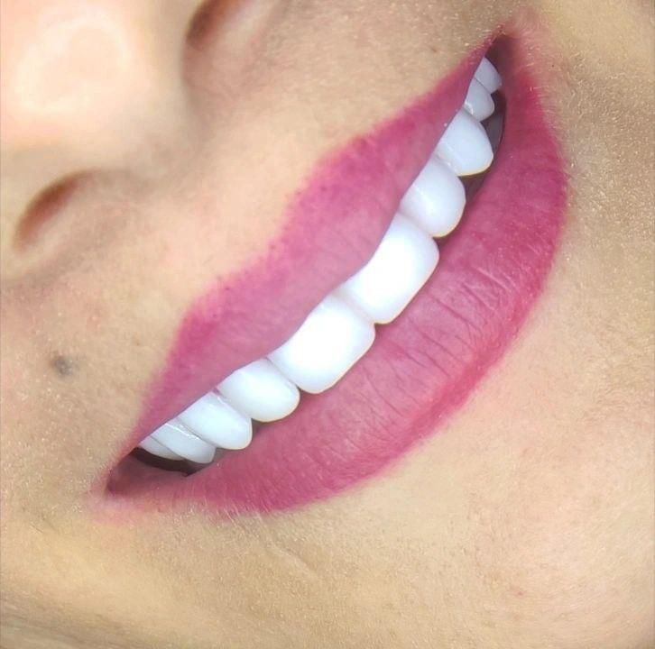 دندان مصنوعی لمینتی .اقساط|خدمات آرایشگری و زیبایی|تهران, نواب|دیوار