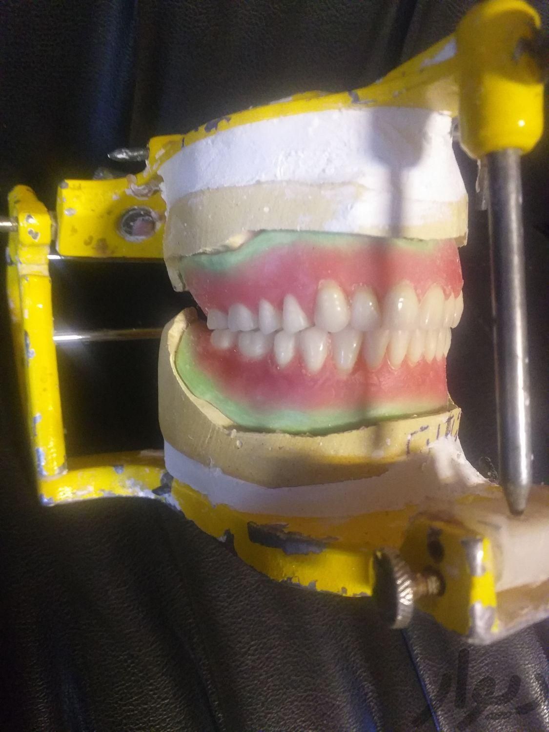 لابراتوار دندان سازی دندان مصنوعی ساخت تعمیر ترمیم|وسایل آرایشی، بهداشتی و درمانی|تهران, دریا|دیوار