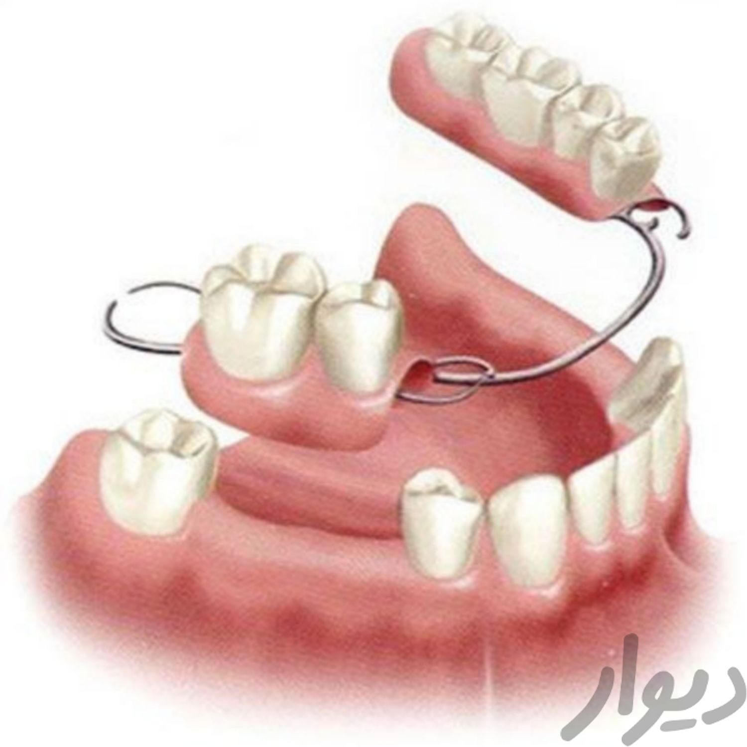 خدمات تخصصی دندانپزشکی با پذیرش بیمه های تکمیلی