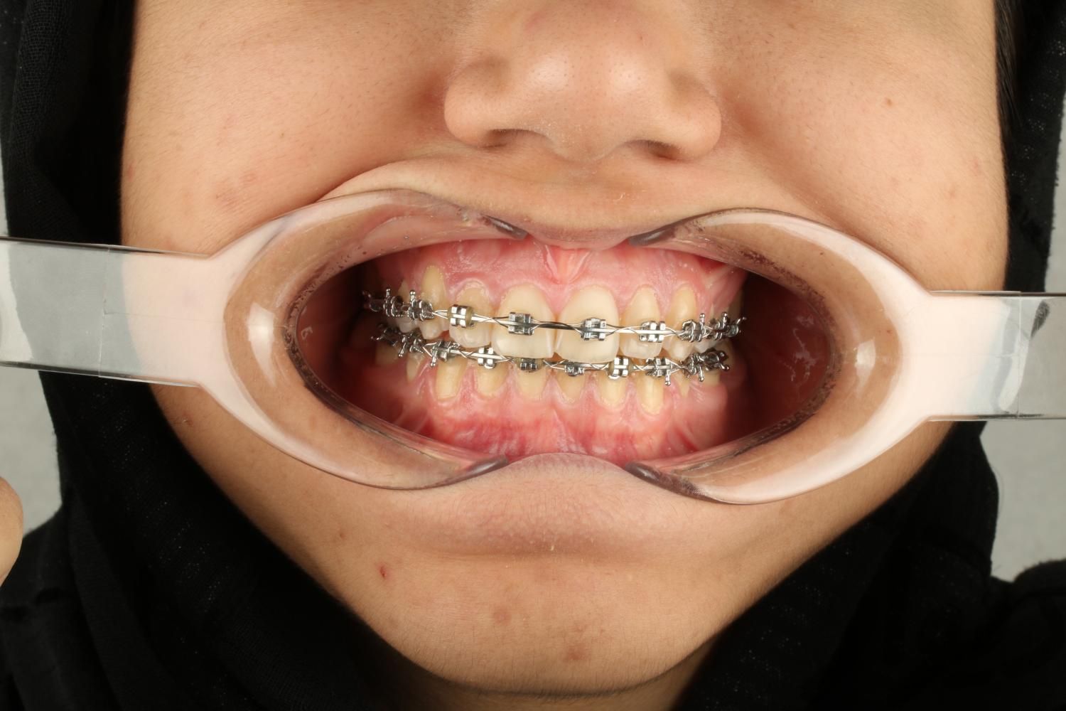 ارتودنسی دندان- دندانپزشکی اطفال-ایمپلنت-کامپوزیت|خدمات آرایشگری و زیبایی|تهران, مشیریه|دیوار