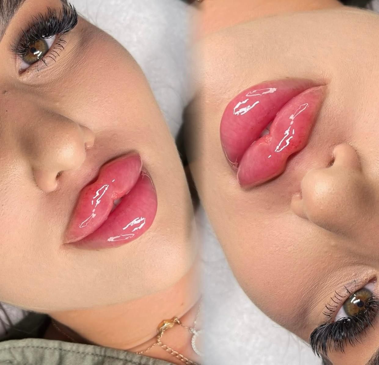 ژل لب فیلر لبروسی بوتاکس مزو جوانساز ژل گونه زاویه|خدمات آرایشگری و زیبایی|کرج, گوهردشت|دیوار