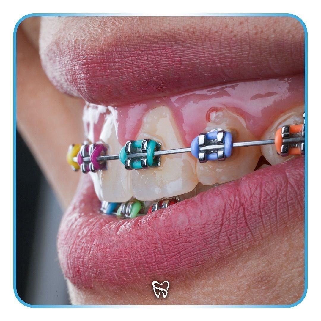 عمل بینی/پیکرتراشی/ارتودنسی/وام بی سود/جراح معروف|خدمات آرایشگری و زیبایی|شیراز, فرهنگ شهر|دیوار