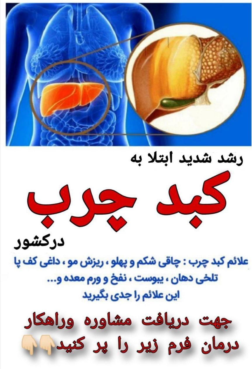 درمان کبد چرب خودرا به ما بسپارید....|خدمات آموزشی|تهران, آرارات|دیوار