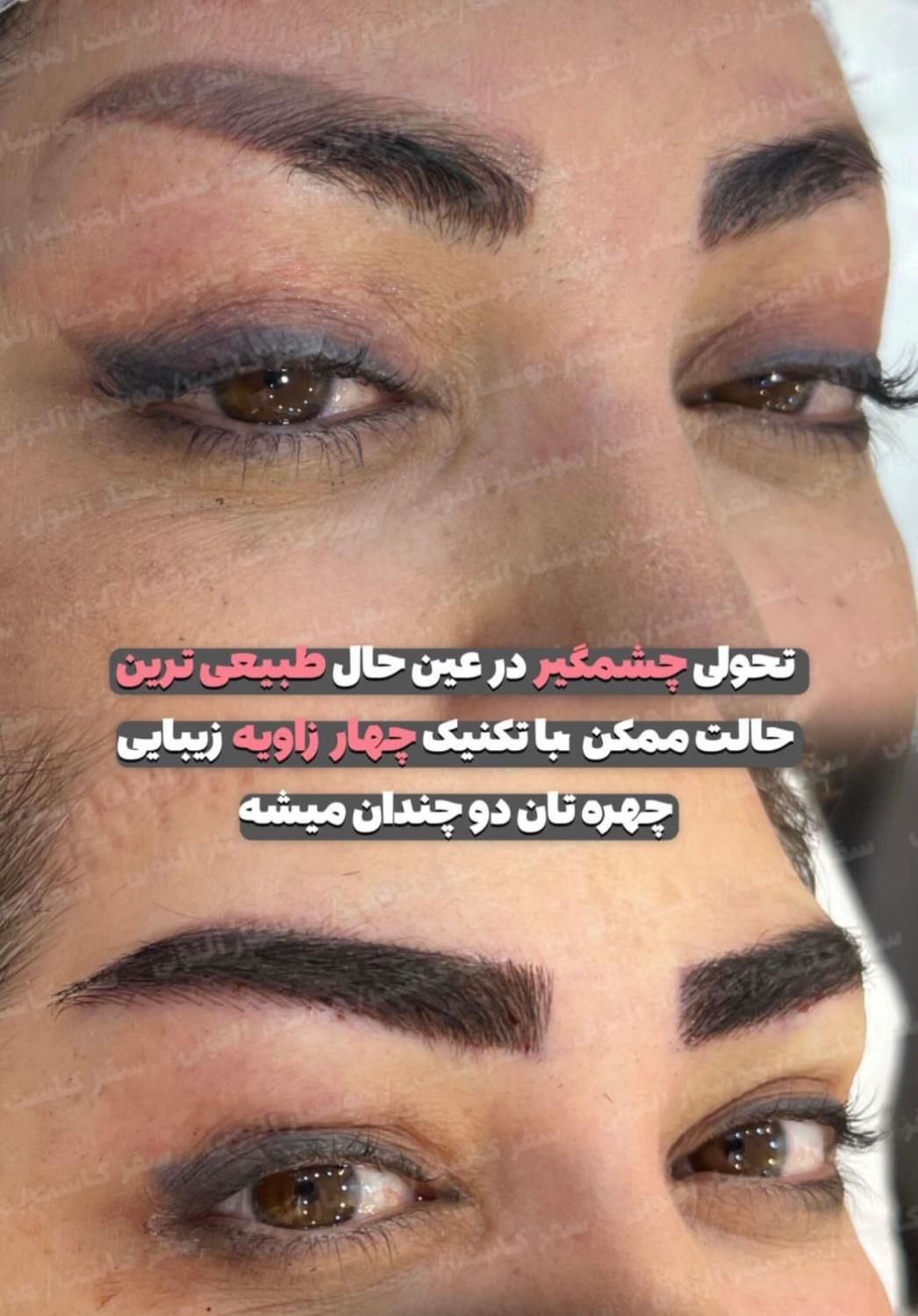 کاشت ابرو پر تراکم با خواب طبیعی|خدمات آرایشگری و زیبایی|تهران, میدان انقلاب|دیوار