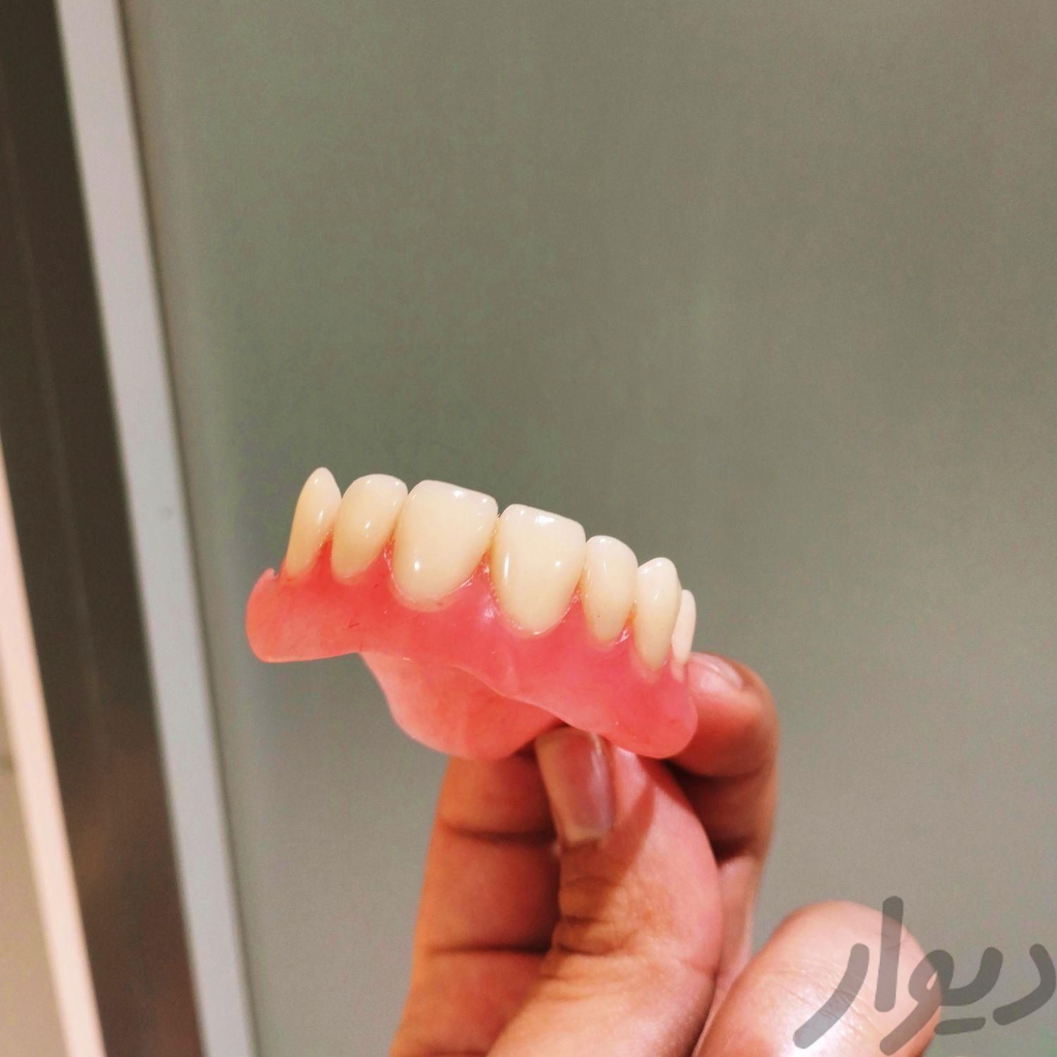 دندان ژله ای|پزشکی|کرج, طالقانی|دیوار