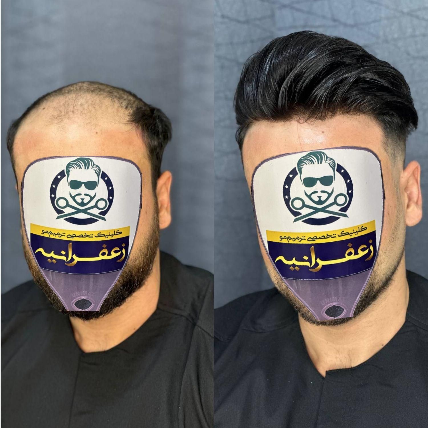 پروتزموترمیم مو پرپشتی مو در1جلسه|خدمات آرایشگری و زیبایی|اصفهان, نقش جهان|دیوار