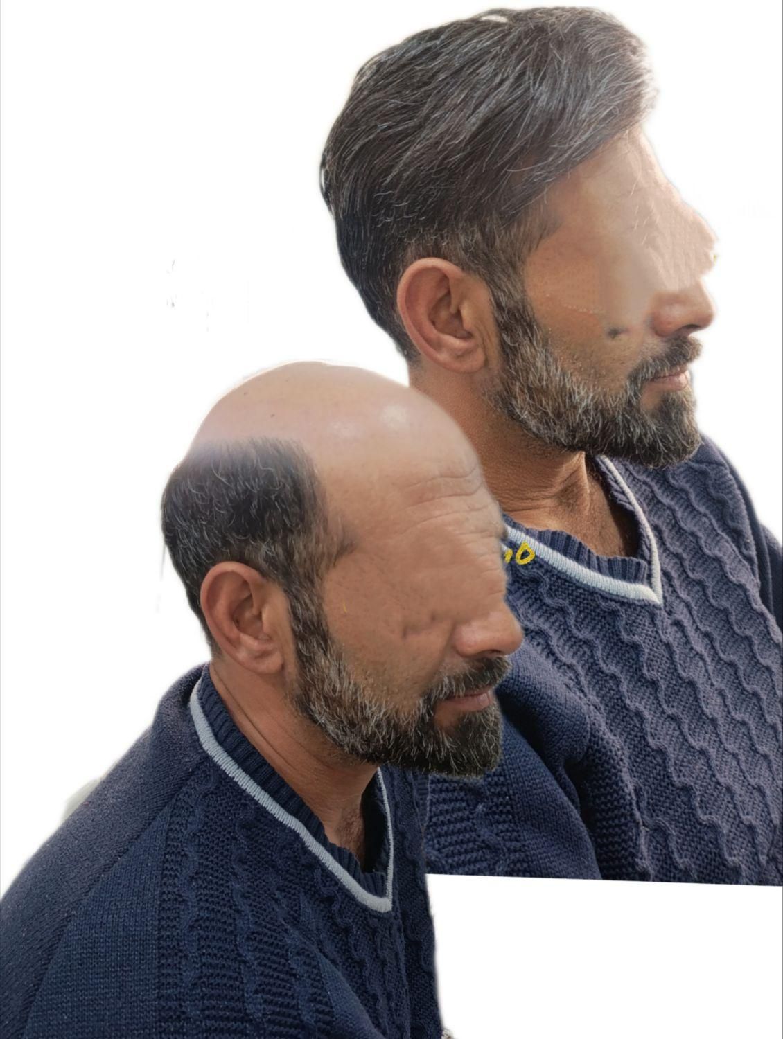 جشنواره نوروزی فروش پروتزمو وارداتی 40%تخفیف|خدمات آرایشگری و زیبایی|شیراز, صاحب الزمان|دیوار
