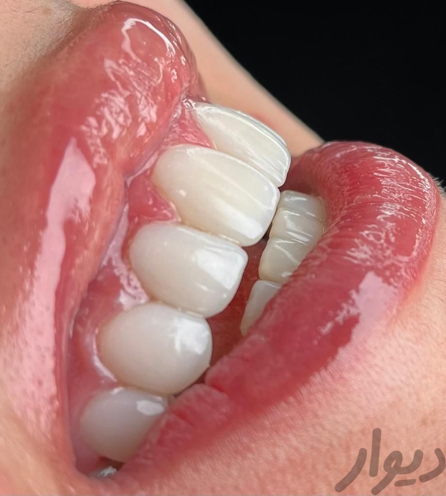 خدمات تخصصی دندانپزشکی با پذیرش بیمه های تکمیلی