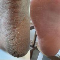 آموزش و خدمات تخصصی پدیکور و کفسابی پا و ژلیش پا|خدمات آرایشگری و زیبایی|اصفهان, احمدآباد|دیوار