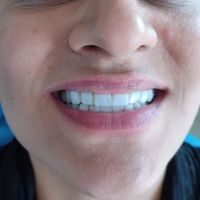 دندانپزشکی.ارتودنسی.عصب کشی.کامپوزیت|خدمات آرایشگری و زیبایی|تهران, مجیدیه|دیوار