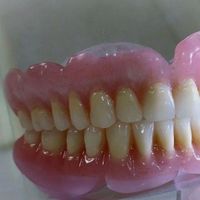 دندانسازی ساخت دندان مصنوعی|خدمات آرایشگری و زیبایی|اصفهان, کلمان|دیوار