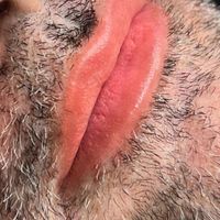 رفع تیرگی لب آقایان سیاهی لب|خدمات آرایشگری و زیبایی|تهران, دریاچه شهدای خلیج فارس|دیوار