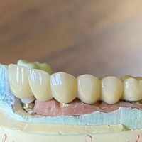 خدمات دندانسازی متحرک (لبخند نهال)|خدمات آرایشگری و زیبایی|تهران, خلیج فارس|دیوار