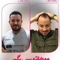 کلینیک تخصصی آوینا|خدمات آرایشگری و زیبایی|تهران, گاندی|دیوار