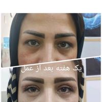 عمل بینی عمل پلک عمل گوش اقساط و نقد|خدمات آرایشگری و زیبایی|شیراز, سینما سعدی|دیوار