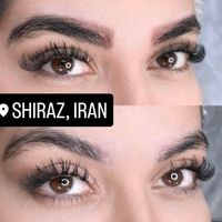 مرکز ریمو،پاک کردن،ریموو تتوابرو.بدن.خط چشم بالیزر|خدمات آرایشگری و زیبایی|شیراز, فرهنگ شهر|دیوار