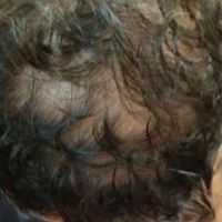 درمان ریزش مو و رشد مجدد مو فقط در چند جلسه|خدمات آرایشگری و زیبایی|مشهد, قوچان|دیوار