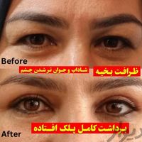 پزشک متخصص زیبایی|خدمات آرایشگری و زیبایی|تهران, شهرک غرب|دیوار