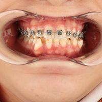 ارتودنسی دندان- دندانپزشکی اطفال-ایمپلنت-کامپوزیت|خدمات آرایشگری و زیبایی|تهران, مشیریه|دیوار