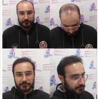 کلینیک تخصصی آوینا|خدمات آرایشگری و زیبایی|تهران, گاندی|دیوار
