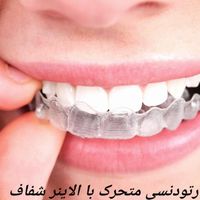 ارتودنسی تخصصی ثابت و متحرک|خدمات آرایشگری و زیبایی|تهران, قبا|دیوار