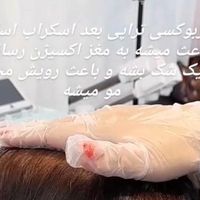 درمان ریزش مو و رشد مجدد مو فقط در چند جلسه|خدمات آرایشگری و زیبایی|مشهد, قوچان|دیوار