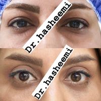 بلفاروپلاستی بلفارو ساکشن غبغب پزشک جراح پلاستیک|خدمات آرایشگری و زیبایی|اصفهان, مرداویج|دیوار