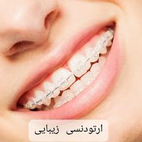 ارتودنسی تخصصی ثابت و متحرک|خدمات آرایشگری و زیبایی|تهران, قبا|دیوار