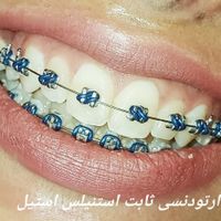 ارتودنسی تخصصی ثابت و متحرک|خدمات آرایشگری و زیبایی|تهران, قبا|دیوار