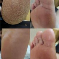آموزش و خدمات تخصصی پدیکور و کفسابی پا و ژلیش پا|خدمات آرایشگری و زیبایی|اصفهان, احمدآباد|دیوار