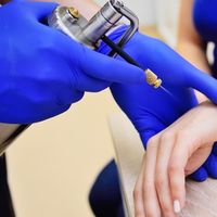 درمان زگیل تناسلی/لیزر/کرایو فریز/hpv/توسط پزشک|خدمات آرایشگری و زیبایی|اهواز, کیانپارس |دیوار