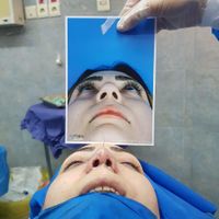 جراحی زیبایی بینی/رینوپلاستی|خدمات آرایشگری و زیبایی|تهران, آرژانتین|دیوار