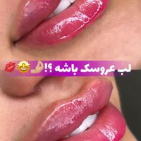 ژل و بوتاکس درافسریه|خدمات آرایشگری و زیبایی|تهران, افسریه|دیوار