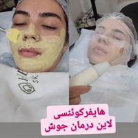 پاکسازی و فیشال صورت و آموزش تخصصی|خدمات آرایشگری و زیبایی|تهران, پیروزی|دیوار