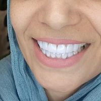 دندانپزشکی.ارتودنسی.عصب کشی.کامپوزیت|خدمات آرایشگری و زیبایی|تهران, مجیدیه|دیوار