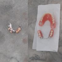 خدمات دندانسازی متحرک (لبخند نهال)|خدمات آرایشگری و زیبایی|تهران, خلیج فارس|دیوار
