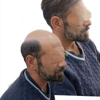 جشنواره نوروزی فروش پروتزمو وارداتی 40%تخفیف|خدمات آرایشگری و زیبایی|شیراز, صاحب الزمان|دیوار